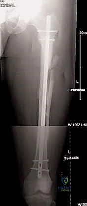 Clinical Image