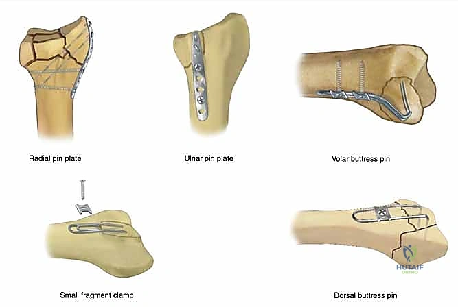 Clinical Image