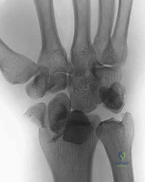 Clinical Image