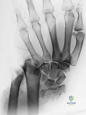 Clinical Image