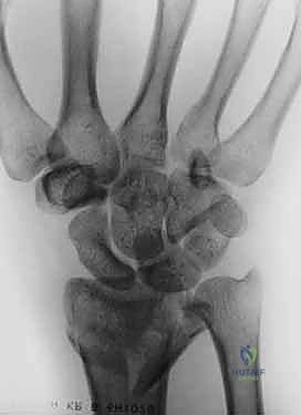 Clinical Image