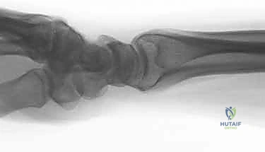 Clinical Image