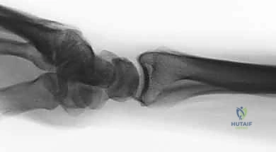 Clinical Image