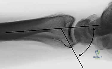 Clinical Image