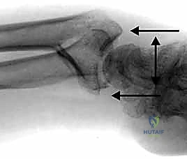 Clinical Image