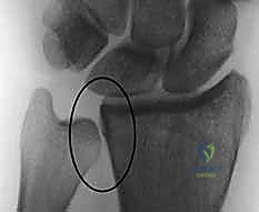 Clinical Image