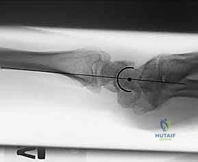 Clinical Image
