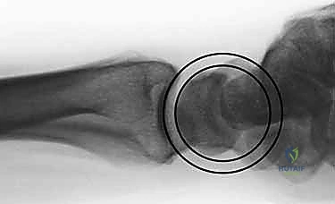 Clinical Image