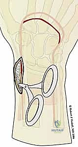 Clinical Image