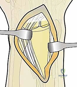 Clinical Image