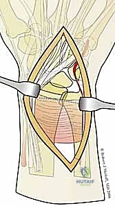 Clinical Image
