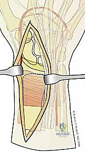 Clinical Image