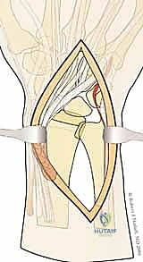 Clinical Image