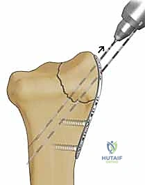 Clinical Image