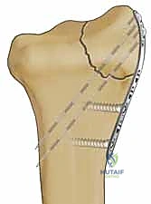 Clinical Image