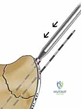 Clinical Image