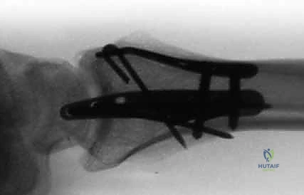 Clinical Image