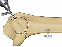 Clinical Image