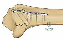 Clinical Image
