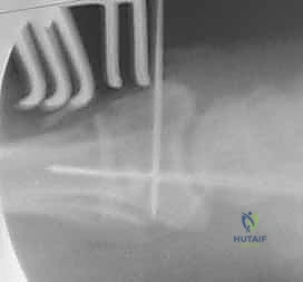 Clinical Image