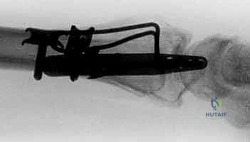 Clinical Image