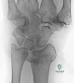 Clinical Image