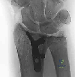 Clinical Image