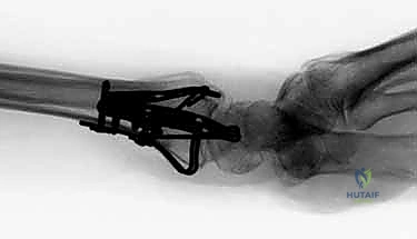 Clinical Image