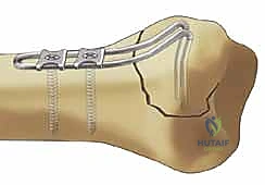 Clinical Image