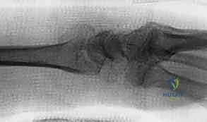 Clinical Image