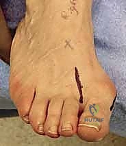 Clinical Image