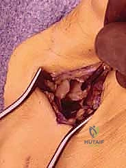 Clinical Image