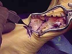 Clinical Image