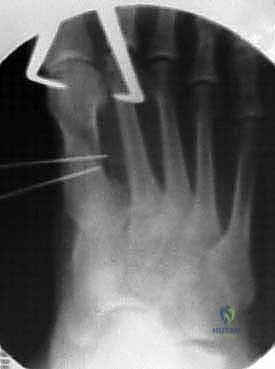 Clinical Image