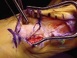 Clinical Image