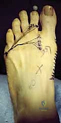 Clinical Image