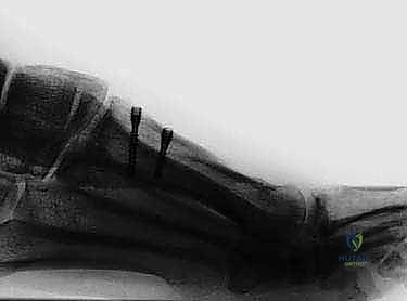 Clinical Image