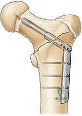 Illustration of younger than years - Dr. Mohammed Hutaif