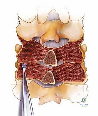 التشريح الأساسي للفقرات العنقية والتركيب العظمي
