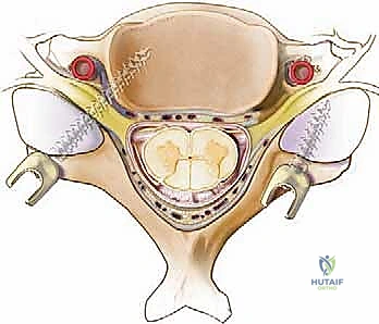 استخدام الميكروسكوب الجراحي والتقنيات المتقدمة في الجراحة