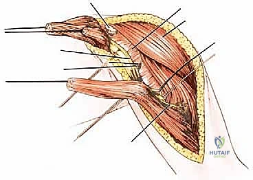 تقييم دواعى الجراحة بناءً على الأشعة