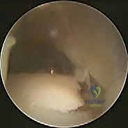 الأعصاب والأوعية الدموية المحيطة بالكاحل