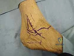 صورة تشريحية لأربطة الكاحل الجانبية