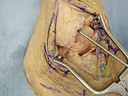 استخدام منظار الكاحل بتقنية 4K للتقييم الدقيق