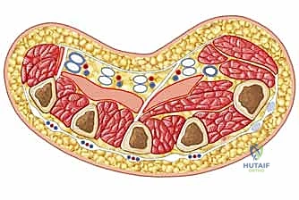 صورة توضيحية لـ علاج التهابات اليد العميقة: دليل شامل من الأستاذ الدكتور محمد هطيف في صنعاء