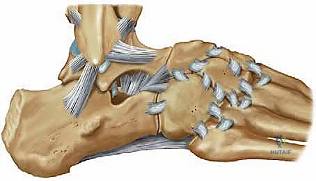 توضيح طبي: التخطيط الجراحي وتحديد مسارات الأربطة التشريحية قبل بدء العملية
