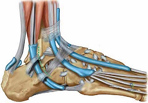 توضيح طبي: سحب الوتر وتحديد الشد المناسب لضمان استقرار المفصل