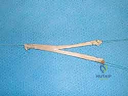 أعراض وعلامات قصور الرباط الدالي