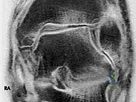 التصوير الشعاعي للكاحل