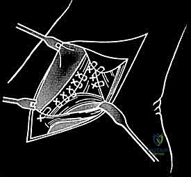 تفاصيل الربط والتثبيت